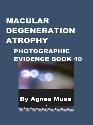 cover image of Macular Degeneration Atrophy, Photographic Evidence Book 10